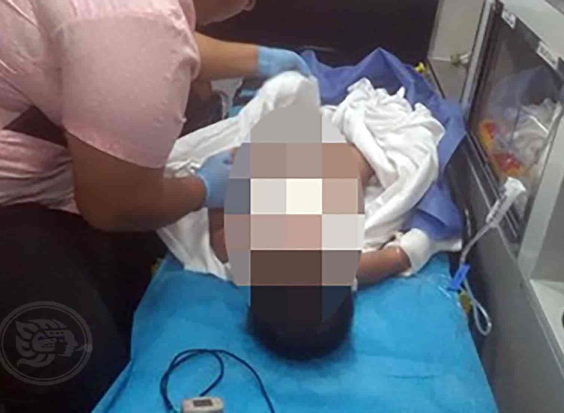 Niño aguadulceño sufre quemaduras con agua hirviendo