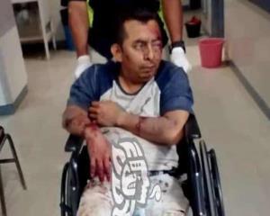 Empleado sayuleño queda fracturado al derrapar en su motocicleta