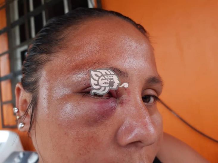 Fuerza Civil golpea a mujer en allanamiento en Sayula; temen represalias 