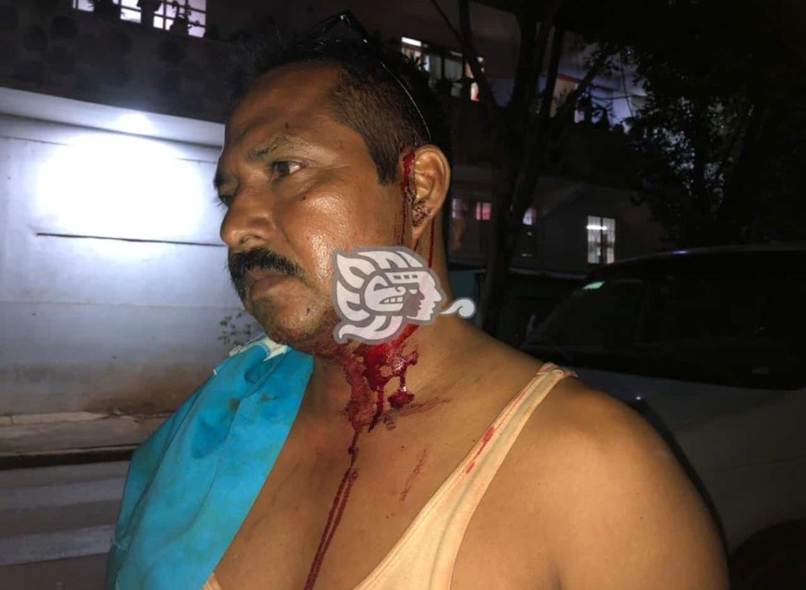 Electricista es golpeado por el ‘sancho’ en Acayucan