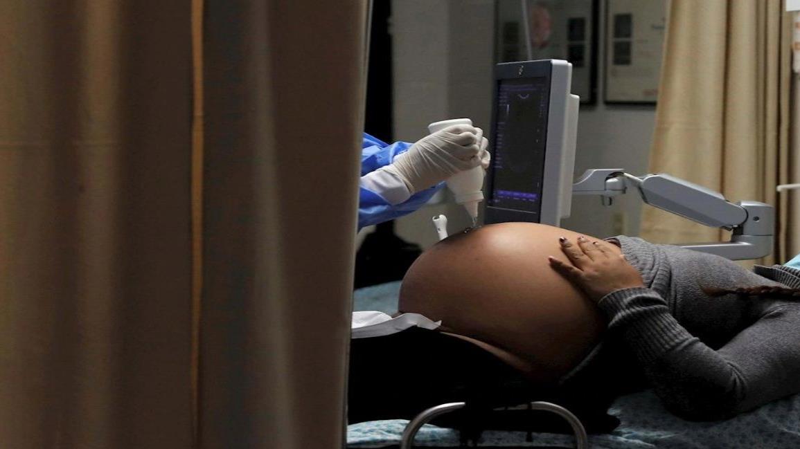 Covid-19 en embarazadas podría ser mortal para el feto: estudio