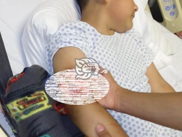 Pitbull ataca a niño de 7 años en Orizaba; familia exige indemnización