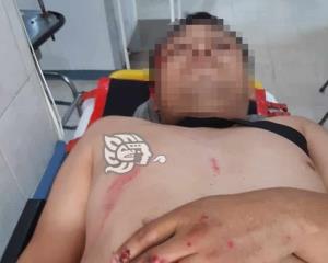 Mecánico sufrió un accidente de motocicleta en colonia de Acayucan