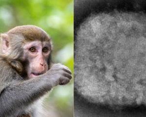 OMS prevé declarar emergencia global por casos de viruela del mono