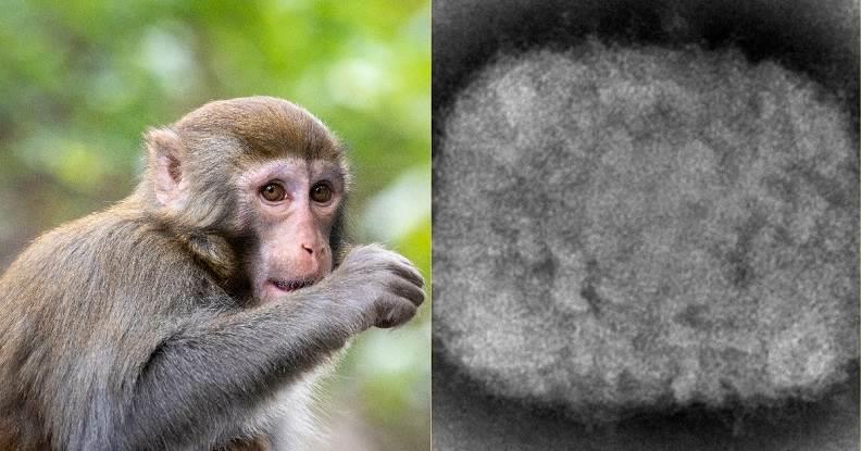 OMS califica de inusuales casos detectados por el brote de viruela del mono en países