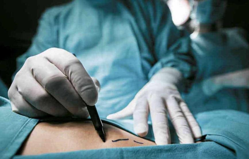 SSa alerta de fake news de reforma a la Ley de Salud en materia de cirugías estéticas