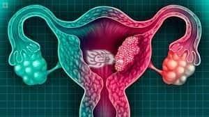 Invitan a mujeres a practicarse estudios para prevenir cáncer cervicouterino