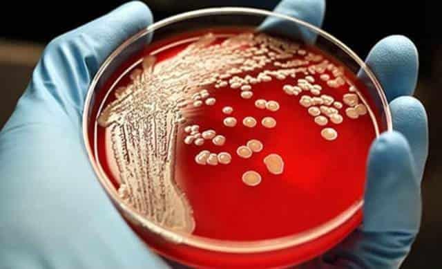 Advierte la OMS por una creciente resistencia de bacterias infecciosas a fármacos