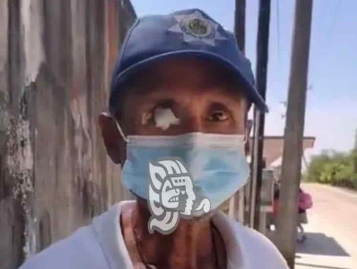 Fallece Chalío en Villa Cuichapa, hace 14 años salvó la vida tras una emboscada