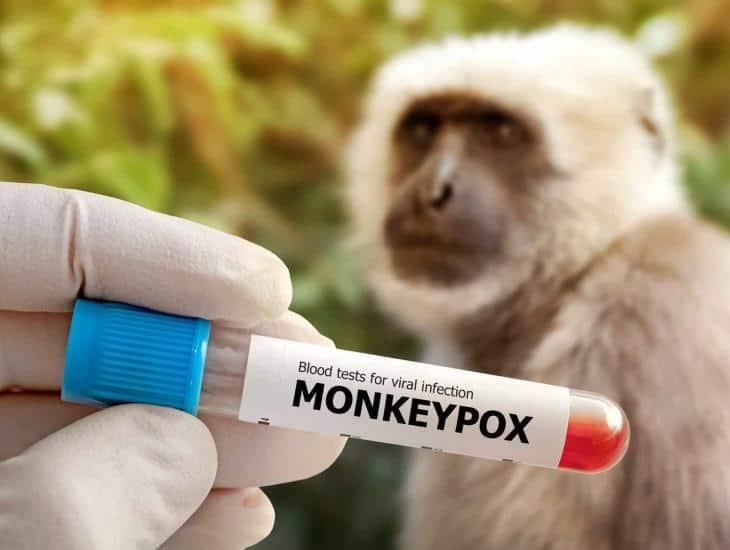 Viruela del mono ya no es emergencia internacional: OMS