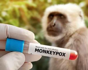 Viruela del mono ya no es emergencia internacional: OMS