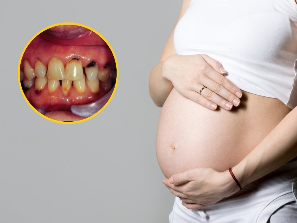 El riesgo para las embarazadas que no se lavan los dientes explicado por un especialista 