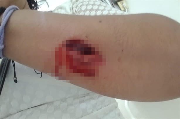 Enfermo mental agredió con un martillo a 2 mujeres en Moloacán