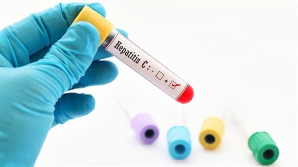 OMS lanza alerta: Hepatitis puede acabar con más vidas que VIH, tuberculosis y malaria juntas