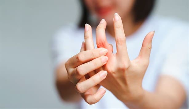 ¿Tronarse los dedos produce artritis? Universidad mexicana aclara si es mito o verdad