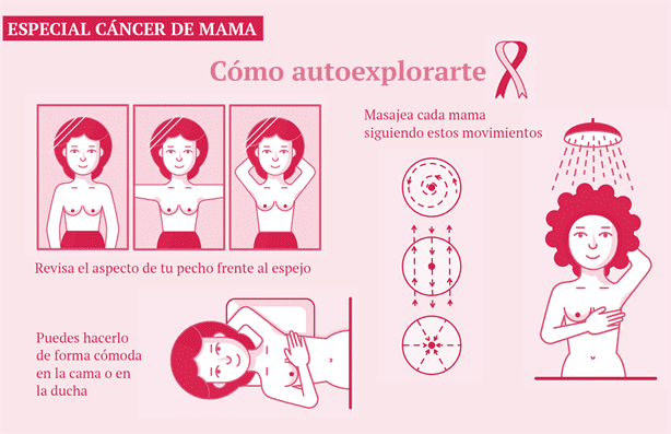 Cáncer de mama en México: a diario 21 mujeres pierden la vida; detección temprana es clave