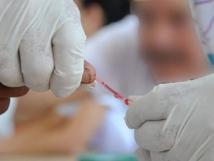 Casos de VIH: Veracruz en primeros lugares desde hace 40 años