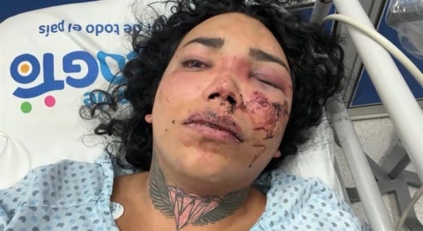 Paolita Suarez de Las Perdidas en el hospital tras ser agredida por su novio