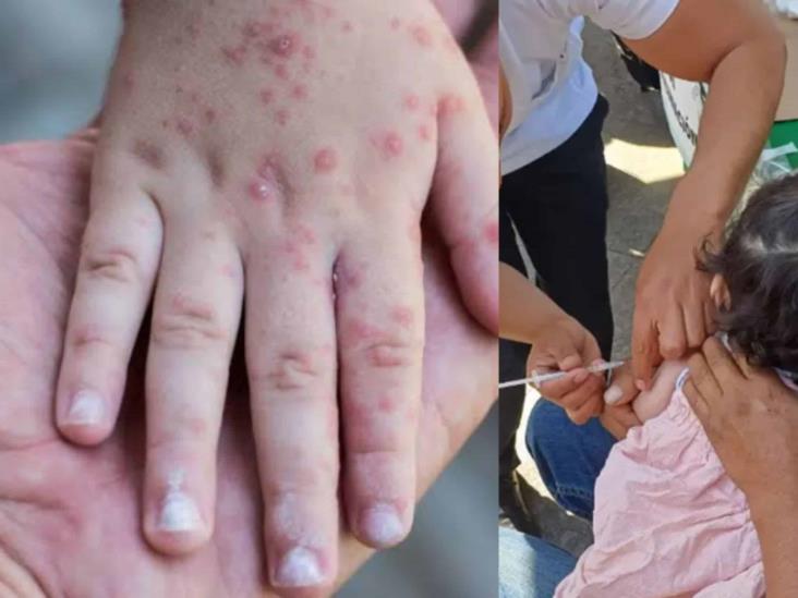 La Secretaría de Salud emite aviso epidemiológico por sarampión, llama a implementar medidas