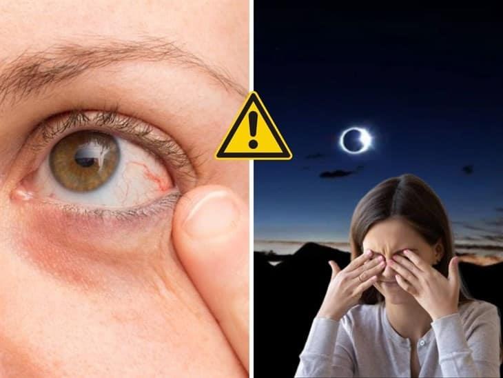 ¿Qué hacer si viste el eclipse solar sin lentes?; toma nota 