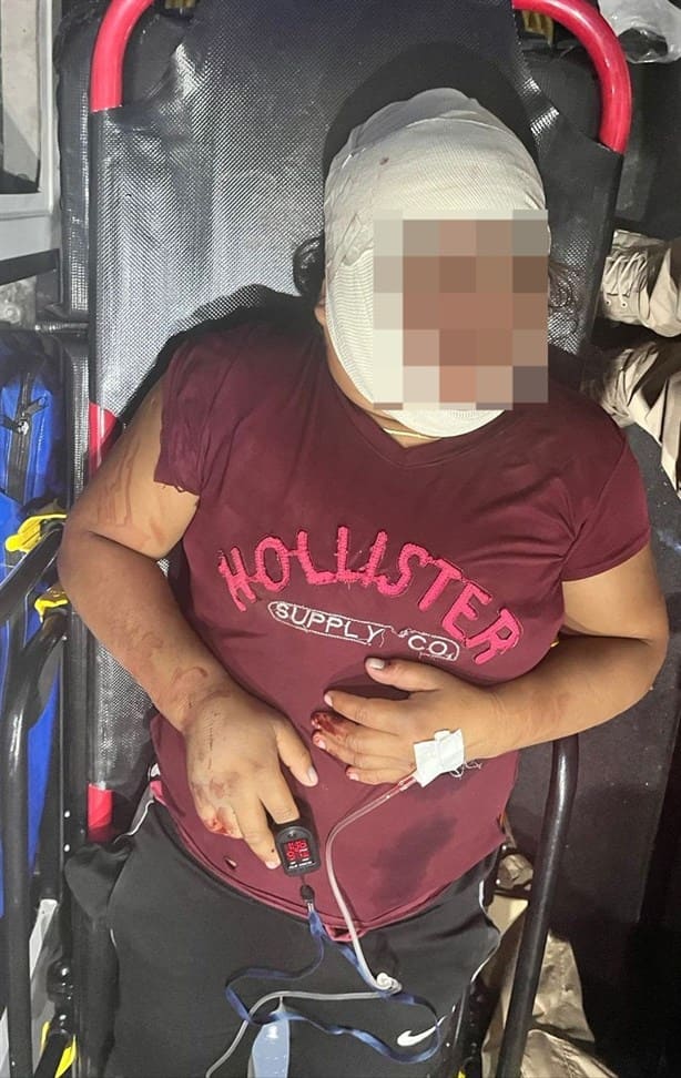 Hombre deja hospitalizada a su esposa tras golpearla con un tubo en Acayucan